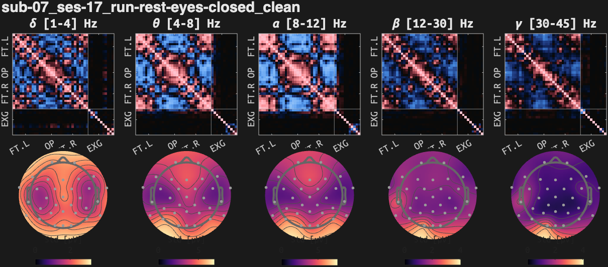 figs/cov-sub-07_ses17_run-rest-eyes-closed_clean.png