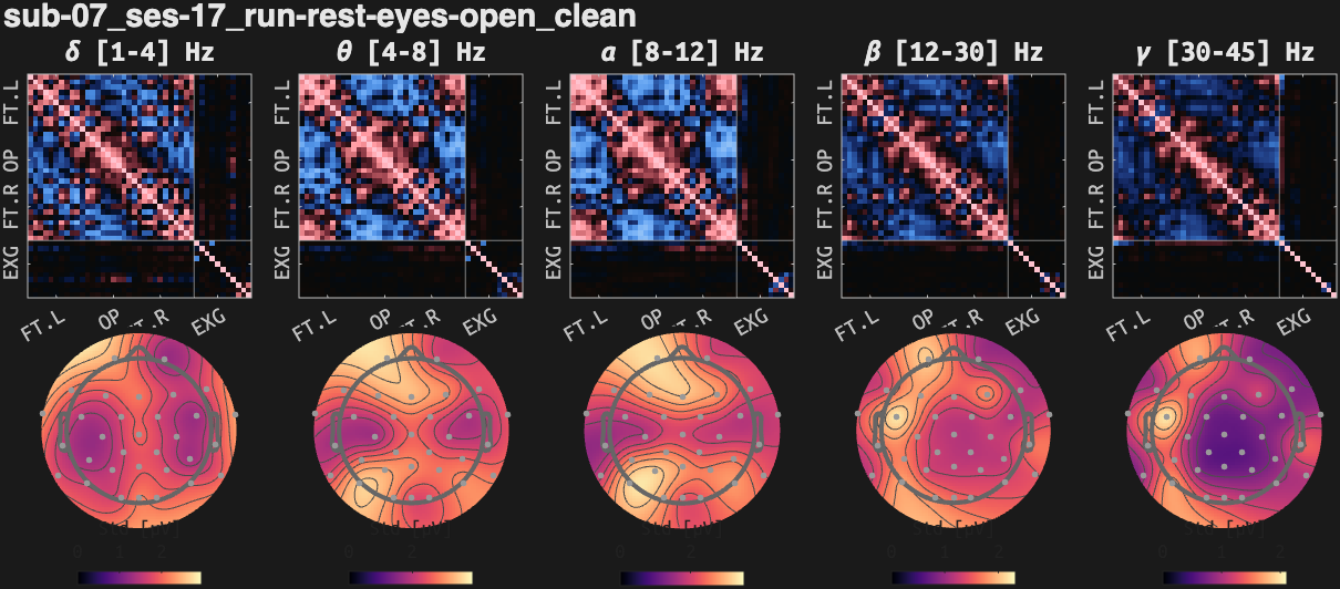 figs/cov-sub-07_ses17_run-rest-eyes-open_clean.png