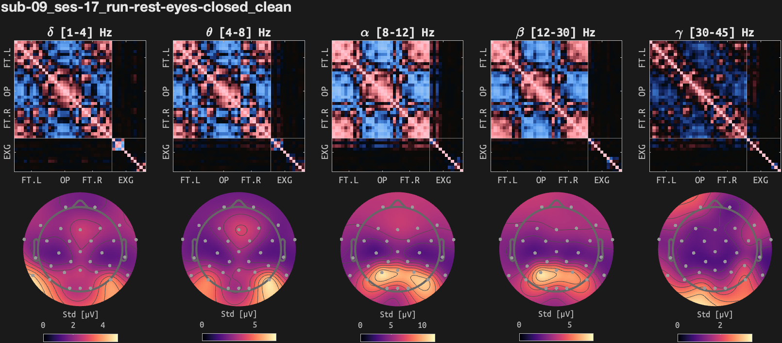 figs/cov-sub-09_ses17_run-rest-eyes-closed_clean.png