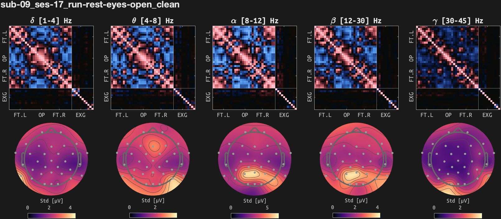 figs/cov-sub-09_ses17_run-rest-eyes-open_clean.png