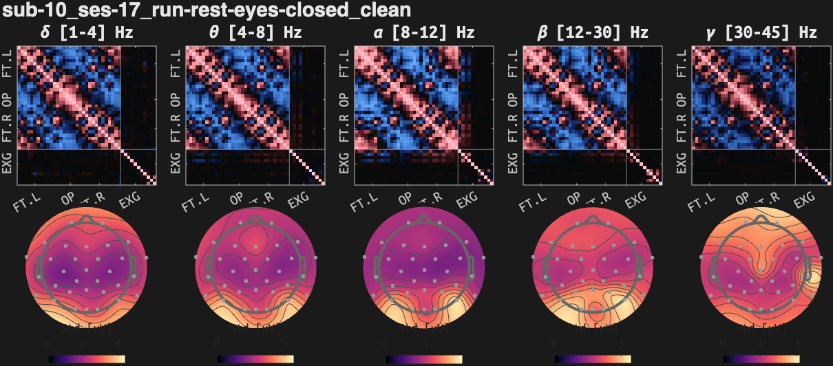 figs/cov-sub-10_ses17_run-rest-eyes-closed_clean.png