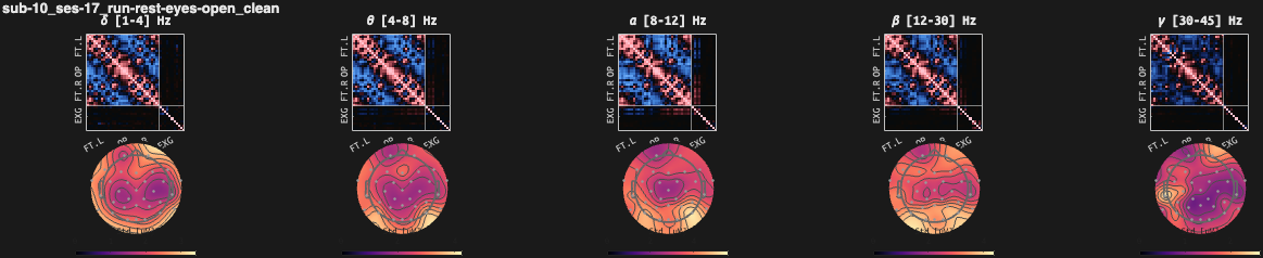 figs/cov-sub-10_ses17_run-rest-eyes-open_clean.png