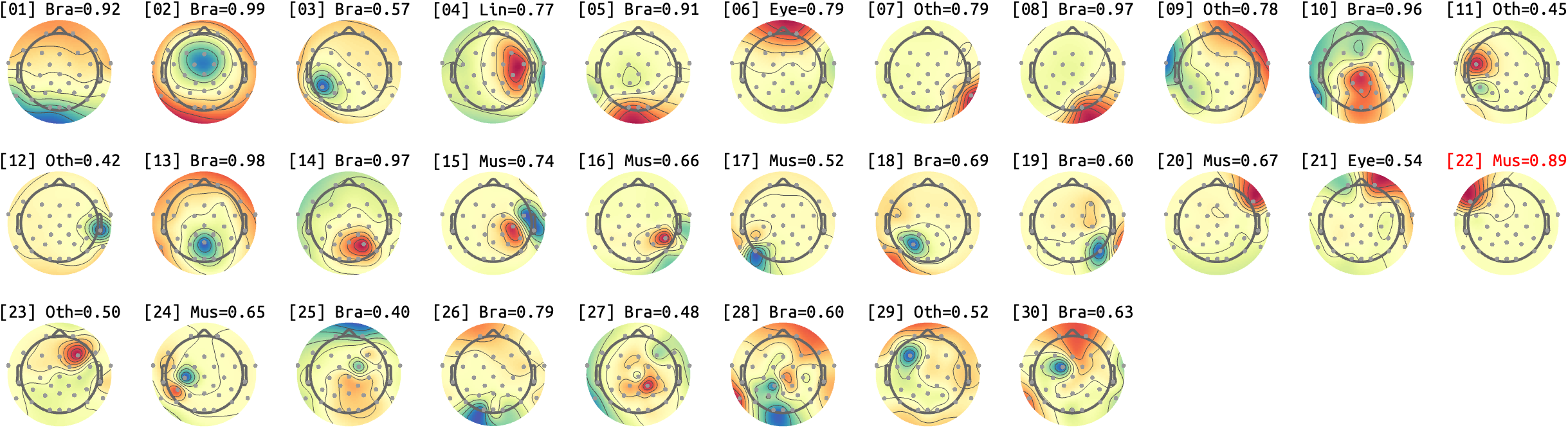 figs/sub-01_ses17_run-rest-eyes-closed.png