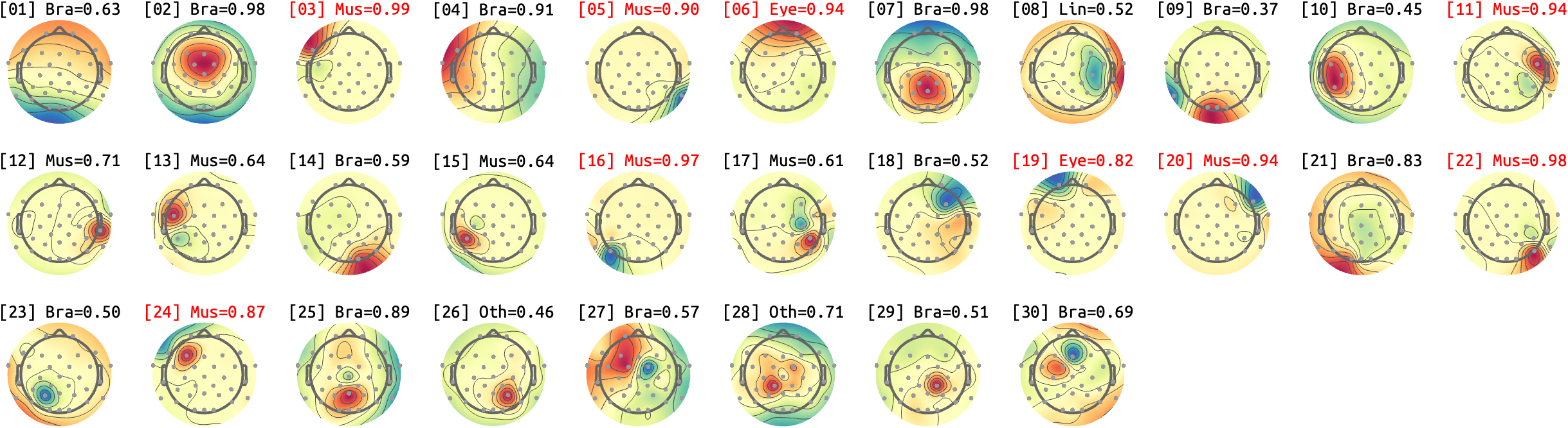 figs/sub-01_ses17_run-rest-eyes-open.png