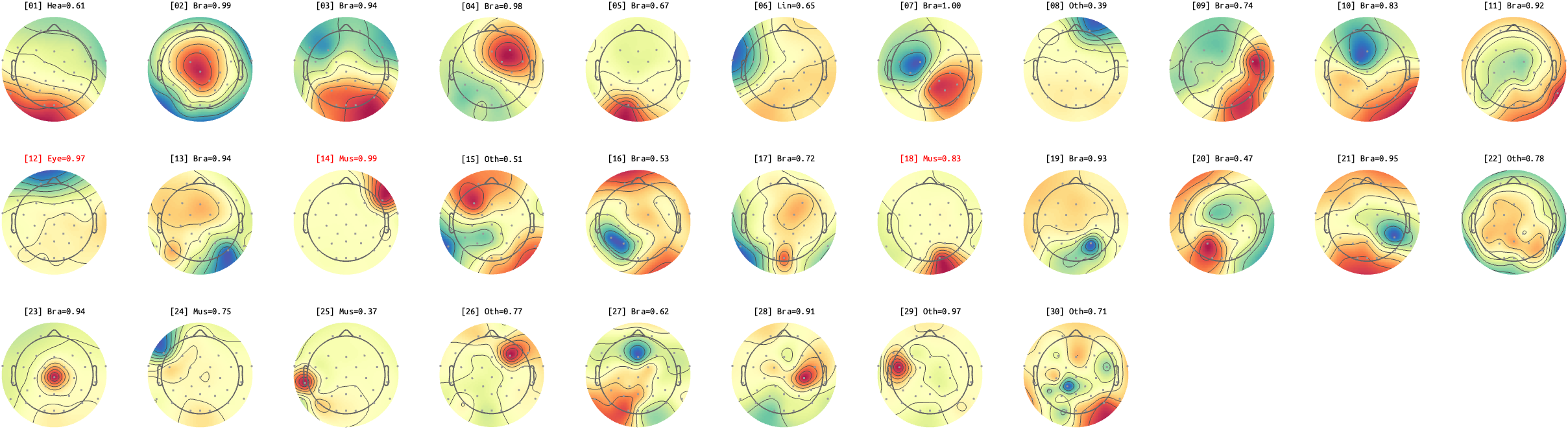 figs/sub-02_ses17_run-rest-eyes-open.png