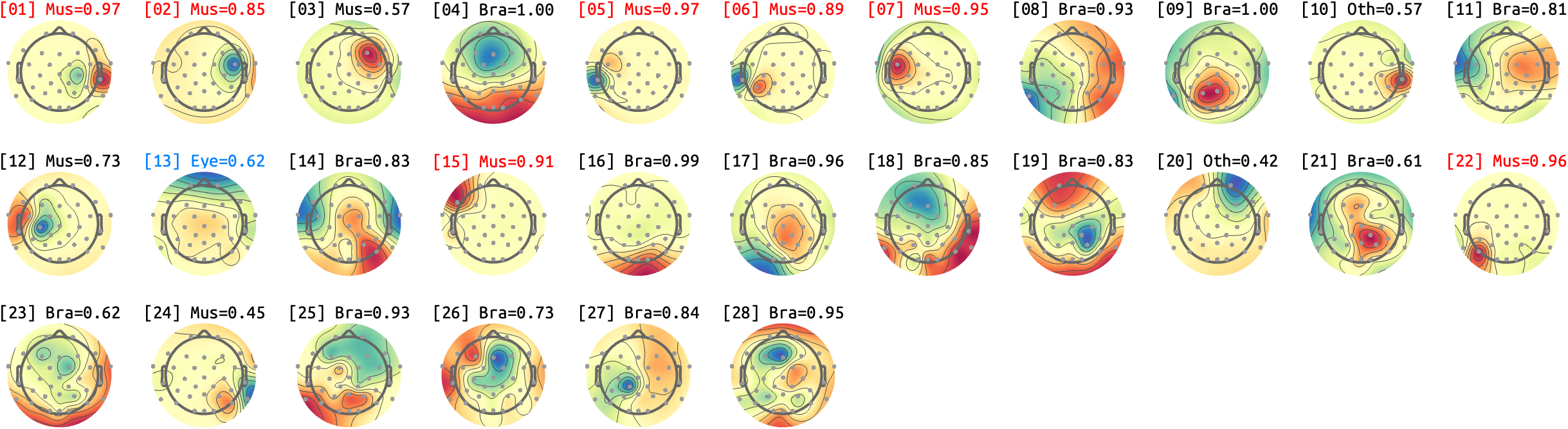 figs/sub-03_ses14_run-rest-eyes-closed.png