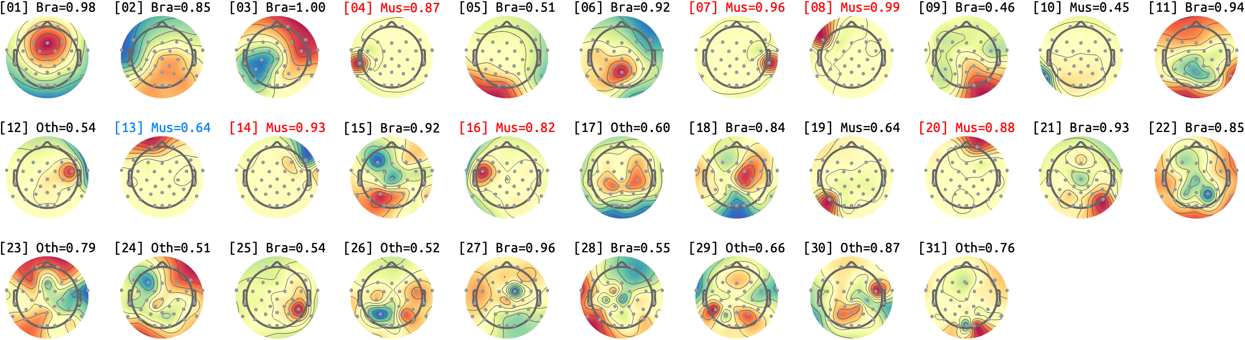 figs/sub-03_ses14_run-rest-eyes-open.png