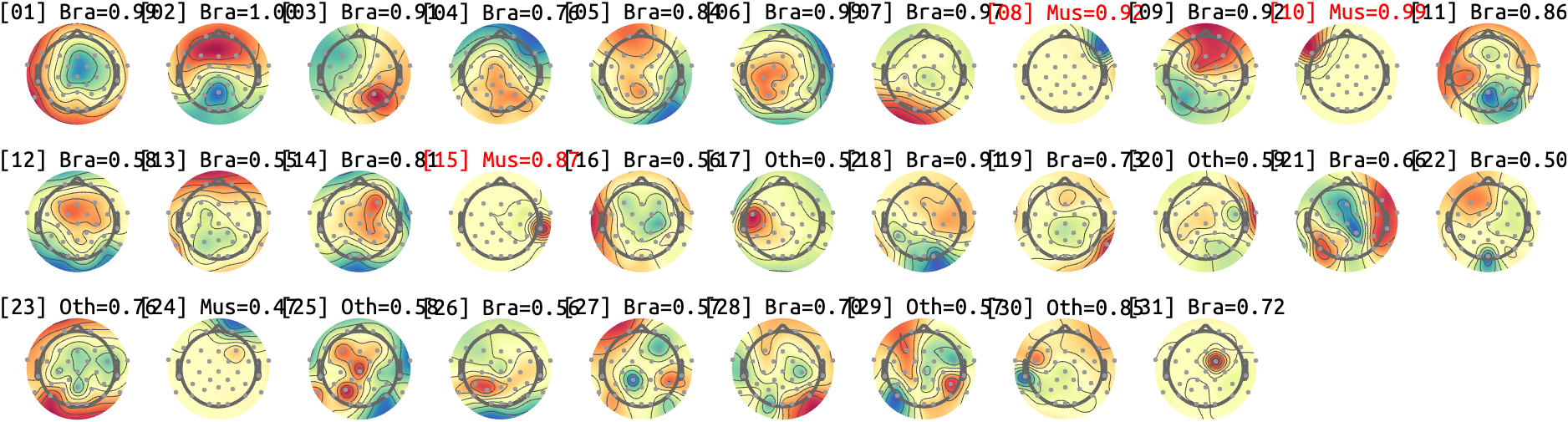figs/sub-03_ses17_run-rest-eyes-open.png