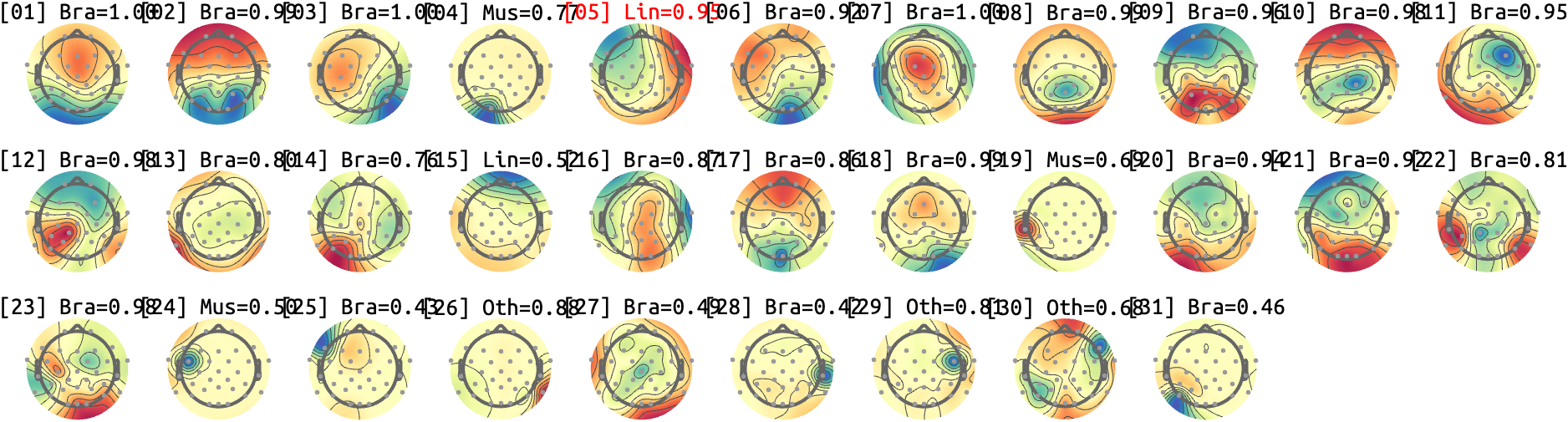 figs/sub-07_ses17_run-rest-eyes-closed.png