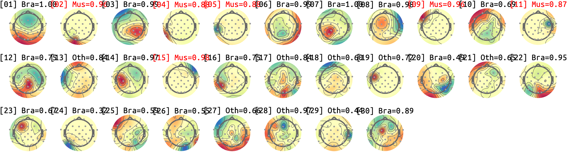 figs/sub-07_ses17_run-rest-eyes-open.png