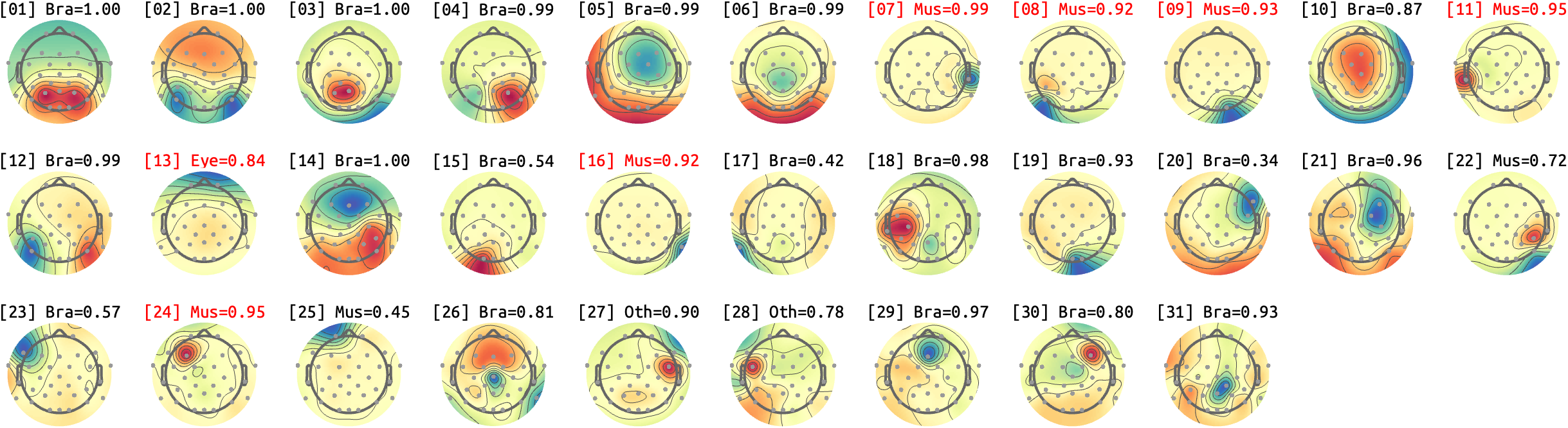 figs/sub-09_ses17_run-rest-eyes-closed.png