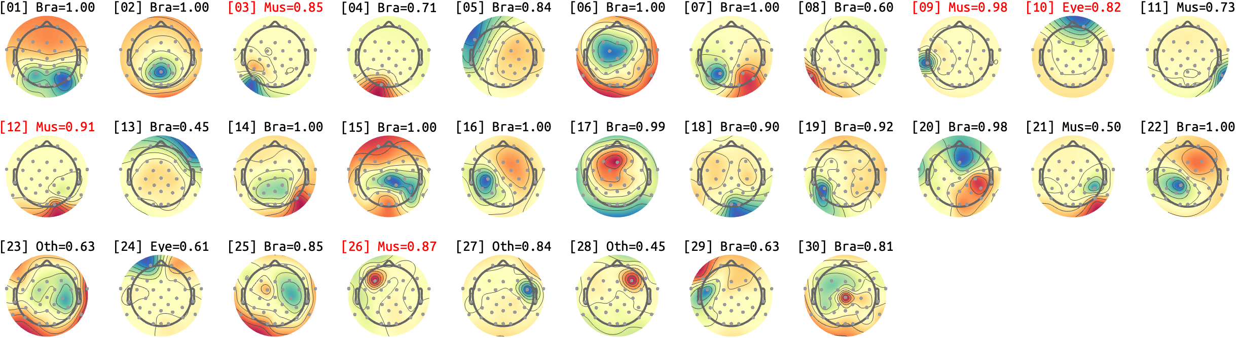 figs/sub-09_ses17_run-rest-eyes-open.png
