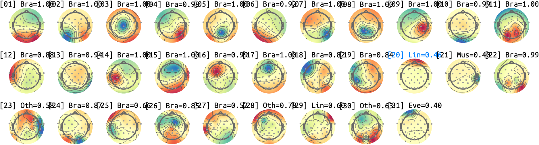 figs/sub-10_ses17_run-rest-eyes-closed.png
