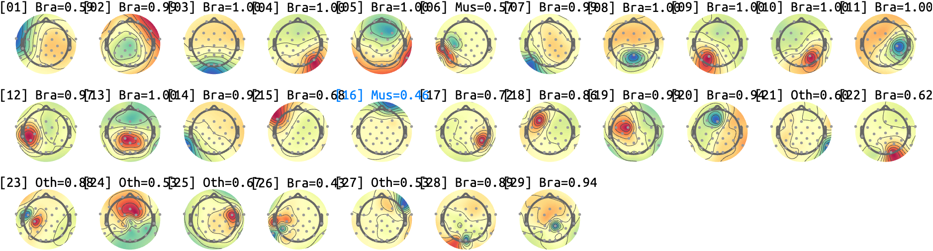 figs/sub-10_ses17_run-rest-eyes-open.png