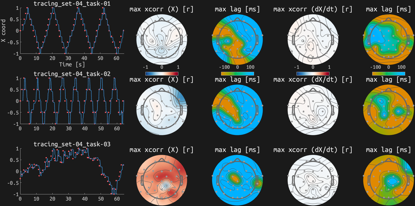 figs/xcorr_sub-02_ses15.png