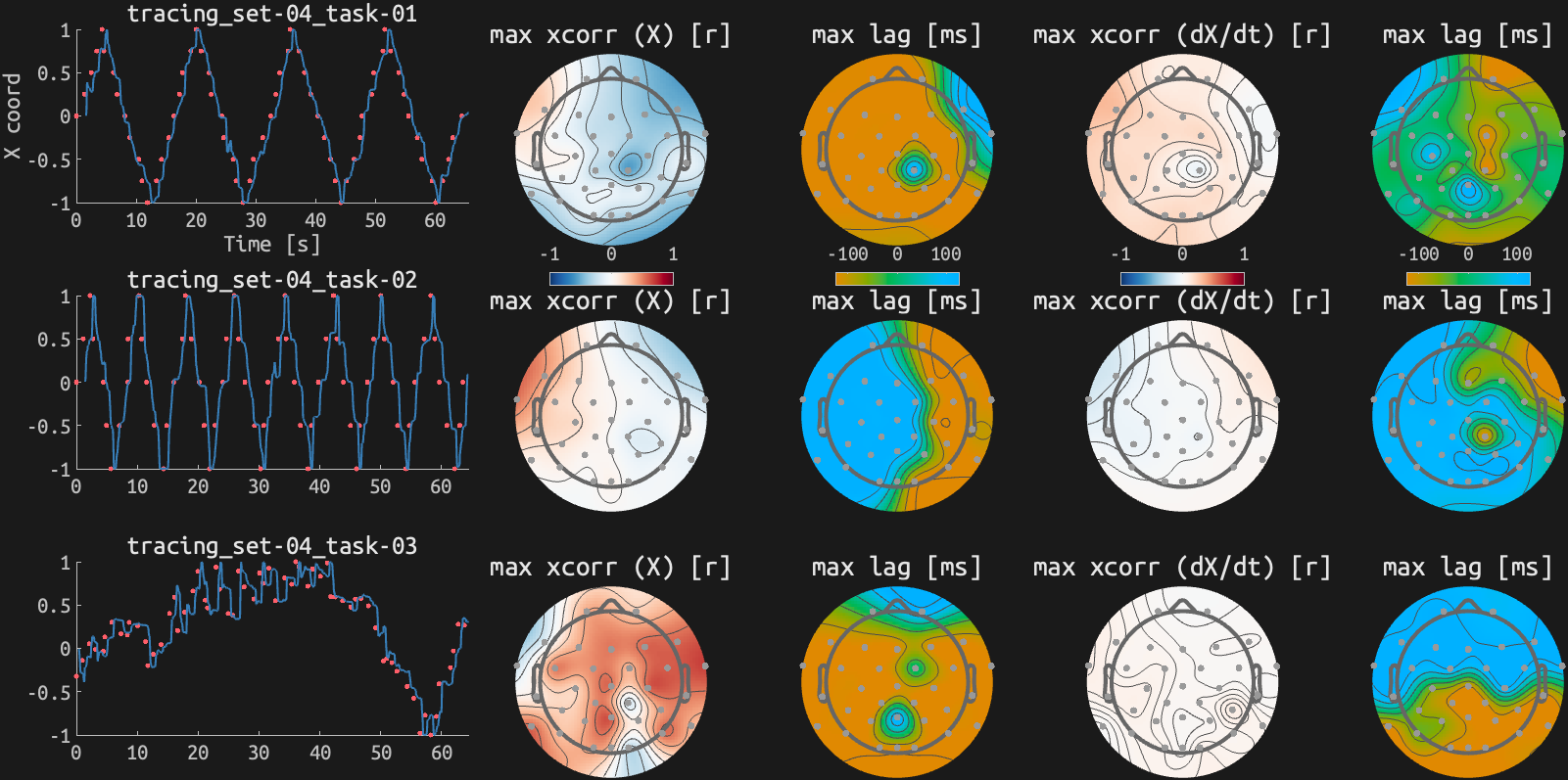 figs/xcorr_sub-03_ses15.png