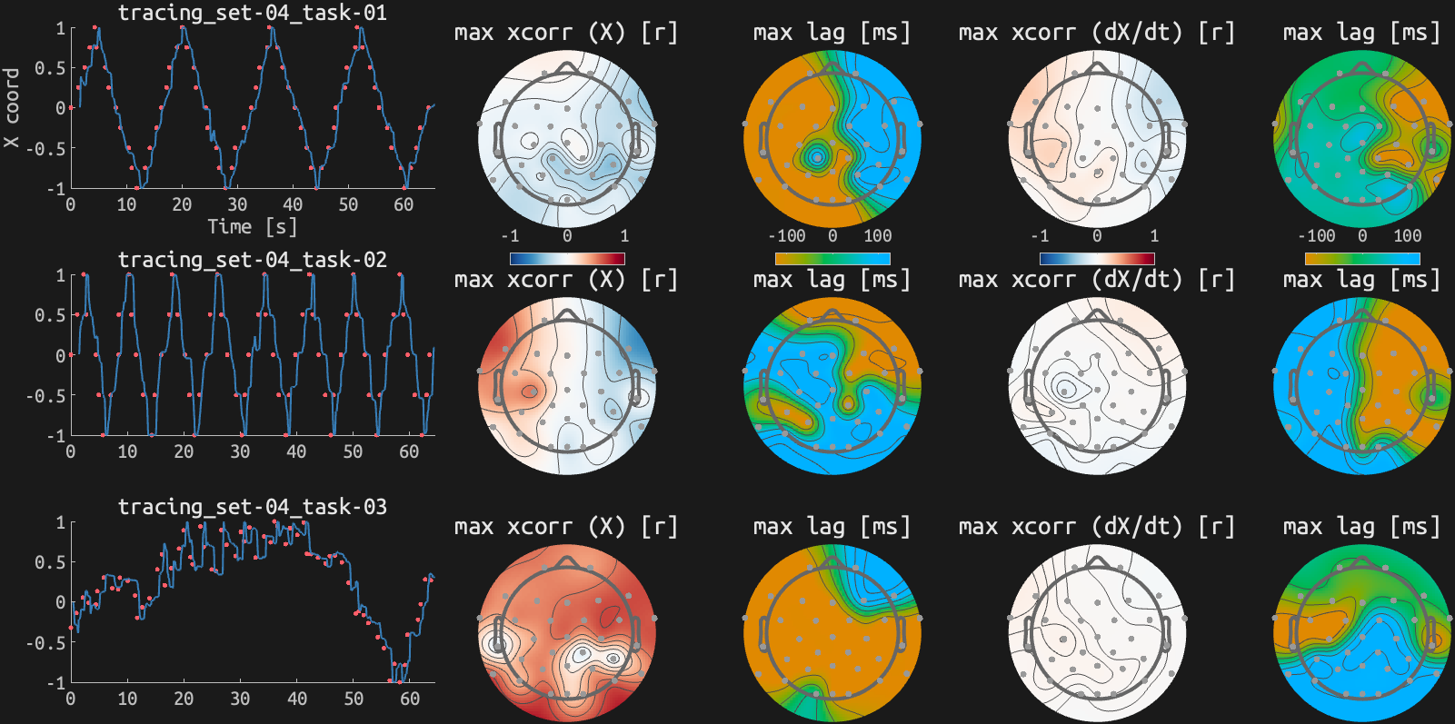 figs/xcorr_sub-07_ses15.png