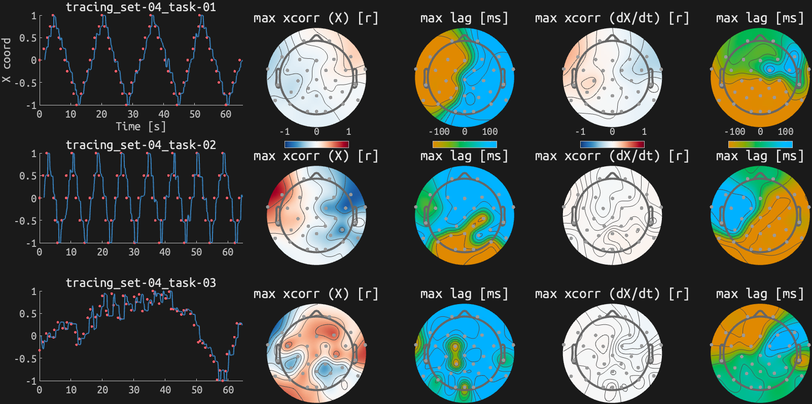 figs/xcorr_sub-09_ses15.png